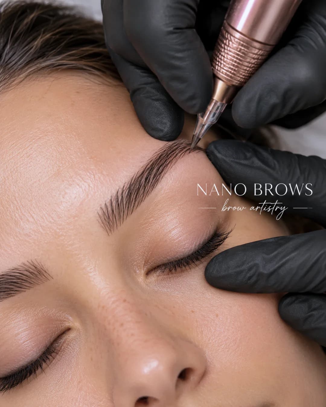 Digital Nano Brow mapping and micro-needle application at Parsa Wellness Clinic