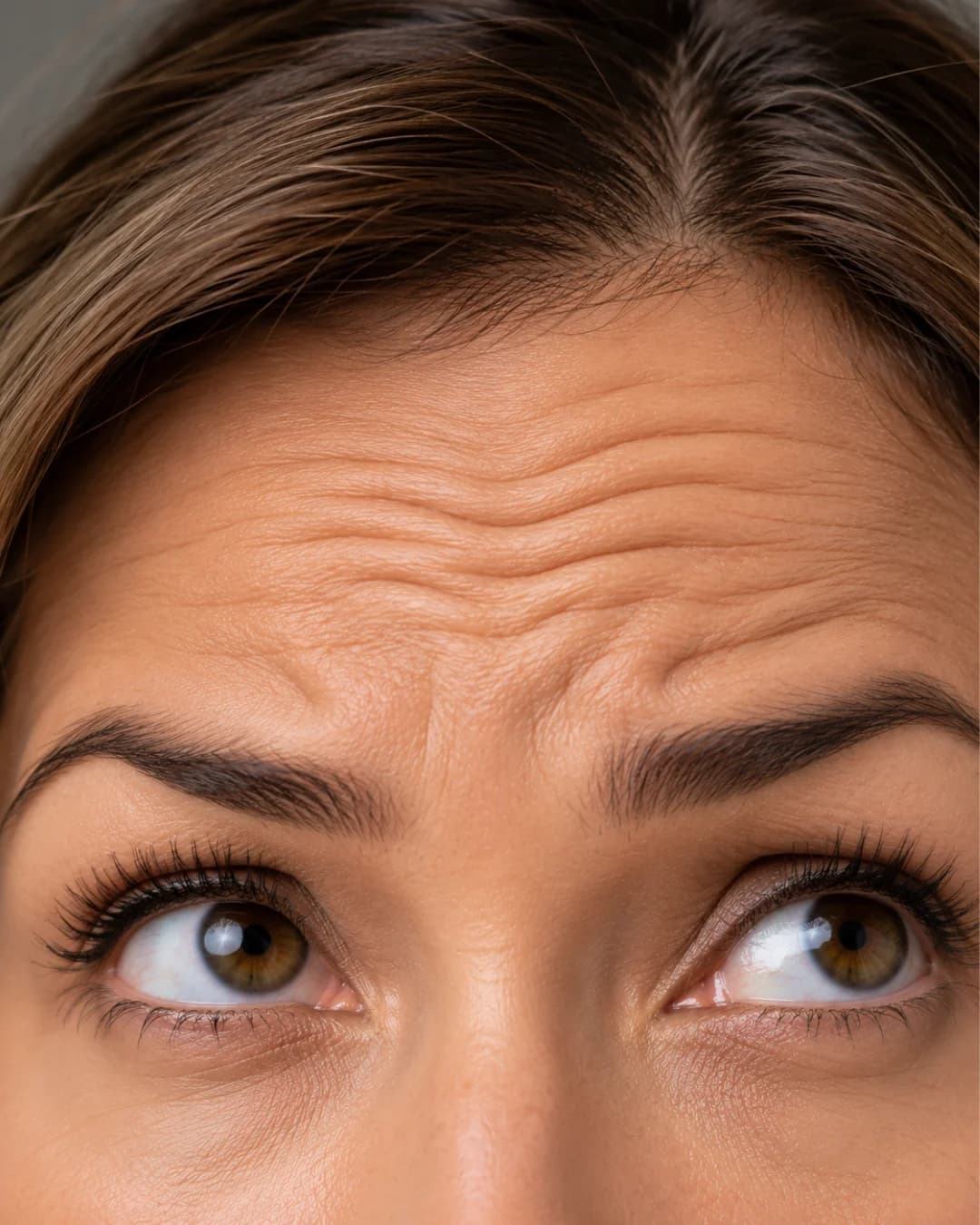 Forehead Lines clinical care and consultation at Parsa Wellness Clinic