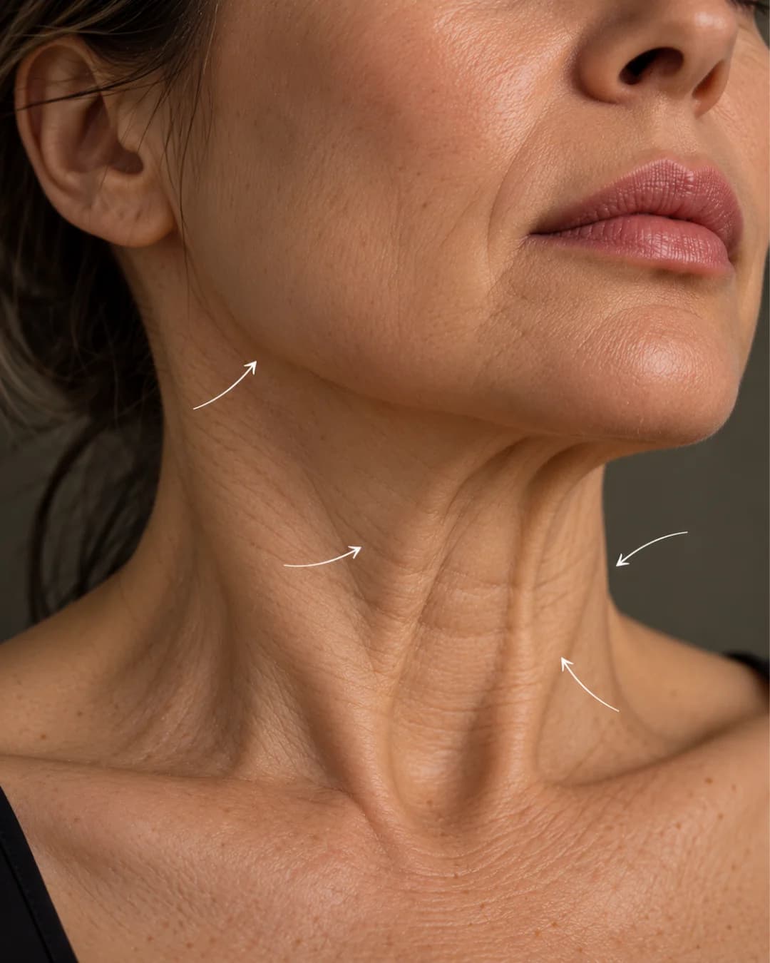 Neck Lines & Loose Neck Skin clinical care and consultation at Parsa Wellness Clinic
