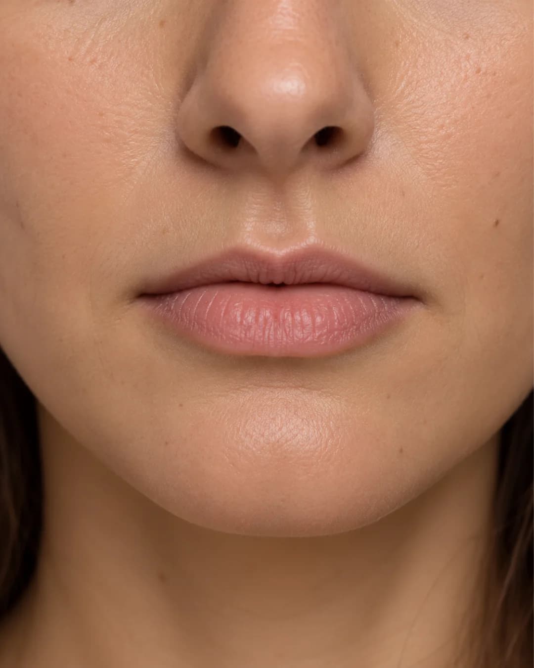 Thin or Dehydrated Lips clinical care and consultation at Parsa Wellness Clinic