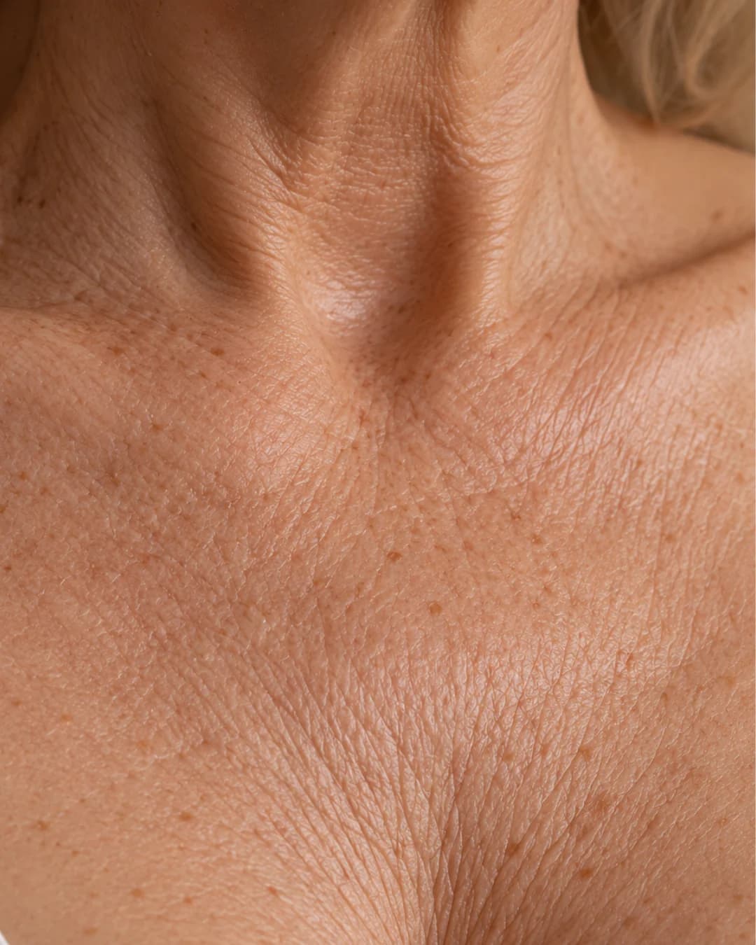 Crepey Chest & Décolletage Skin