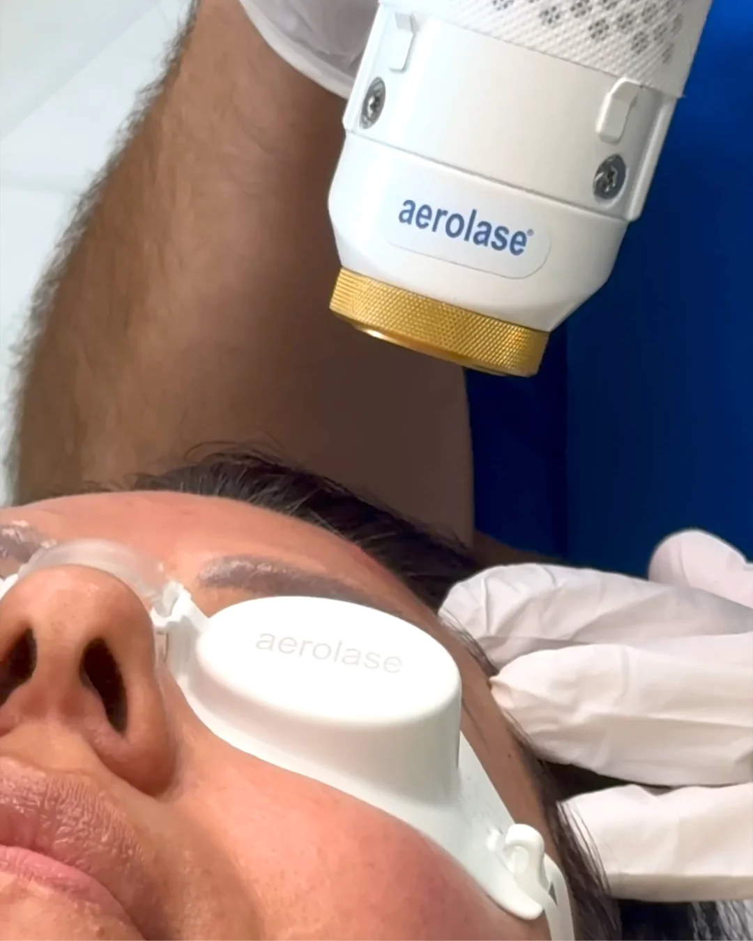 Medical Laser Treatments