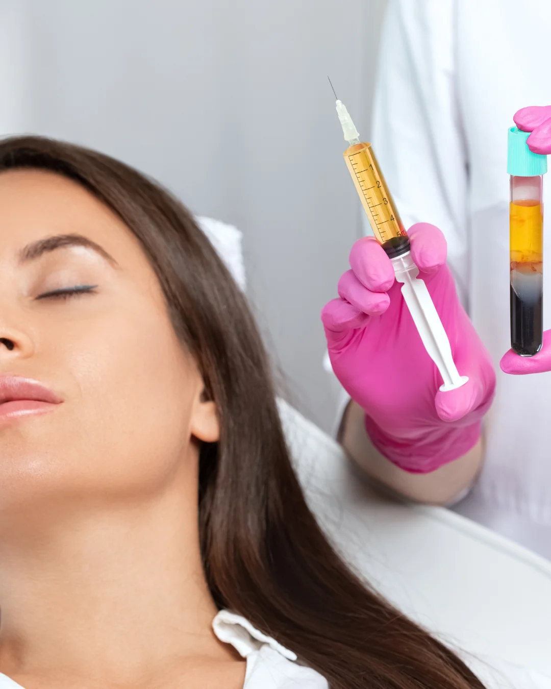 PRP face and hair treatment at Parsa Wellness Clinic