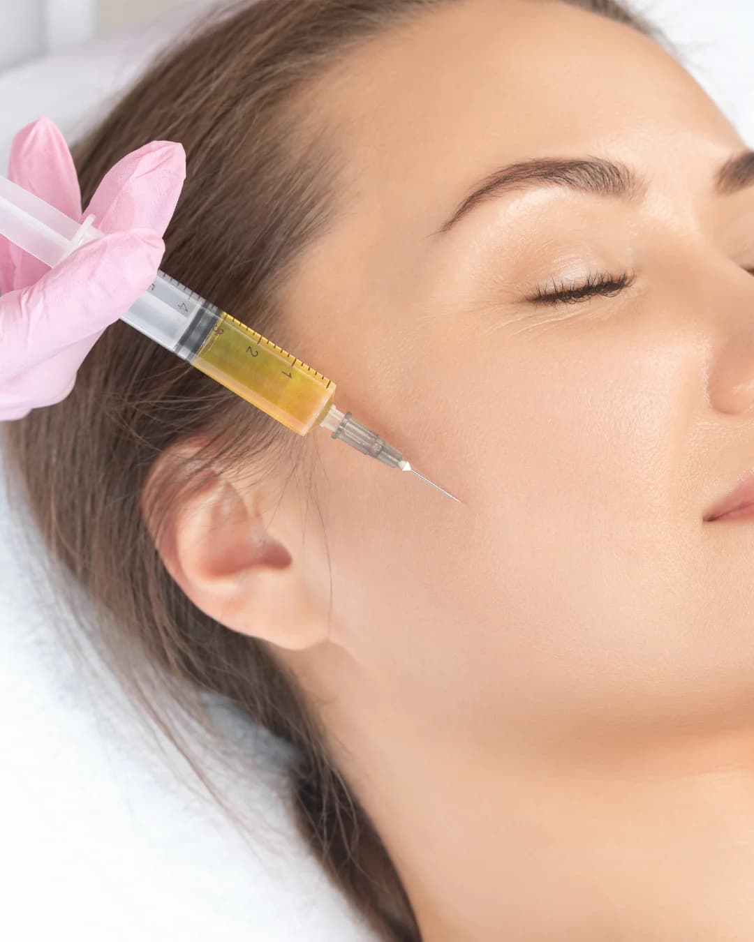 PRP facial rejuvenation treatment